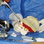 Cirurgia endoscopica